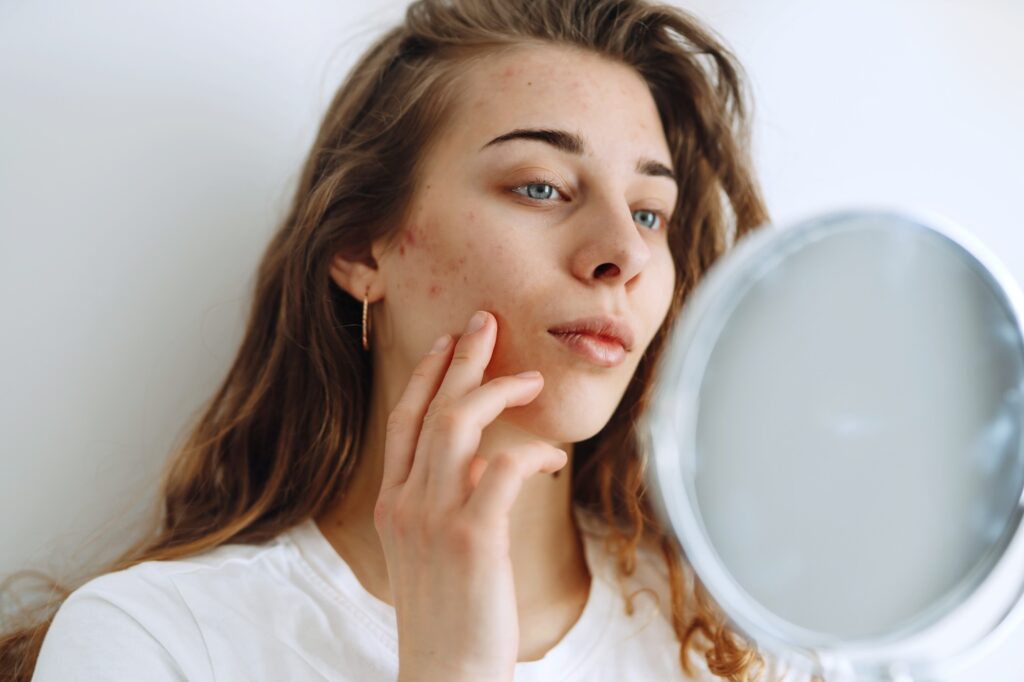 Probleminės odos priežiūra: kokių kasdienės rutinos žingsnių vertėtų nepraleisti?