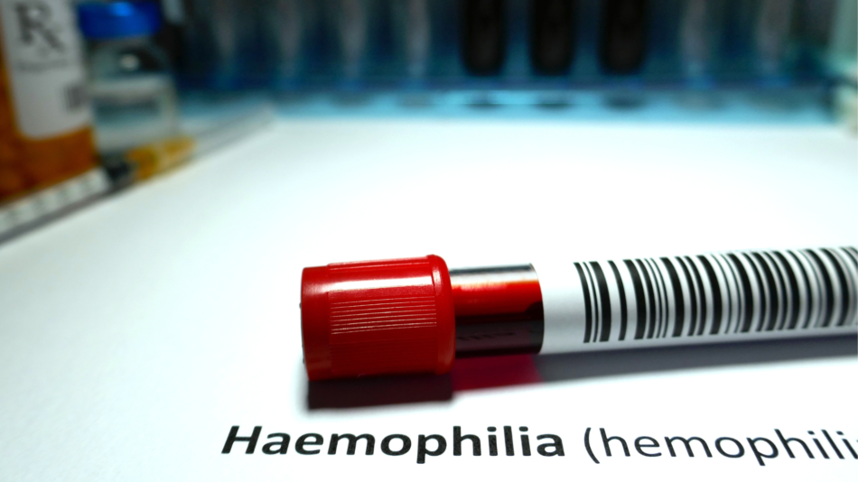 Genetinės ligos diagnozė nepakeičia svajonių: gyvenimas su hemofilija šiandien